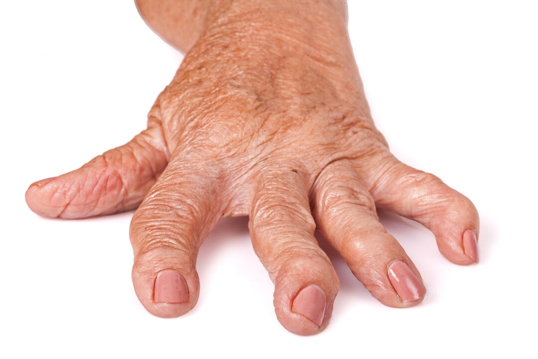 HondroFrost for joint pain relief
