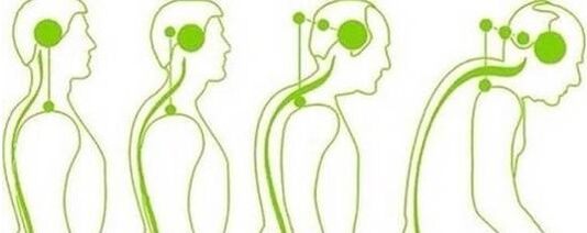 The cervical spine loses the ability to exercise