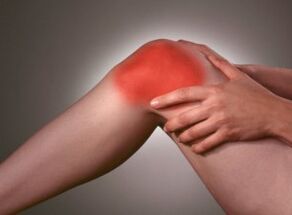 Symptoms of arthritis are serious pain in the knee area