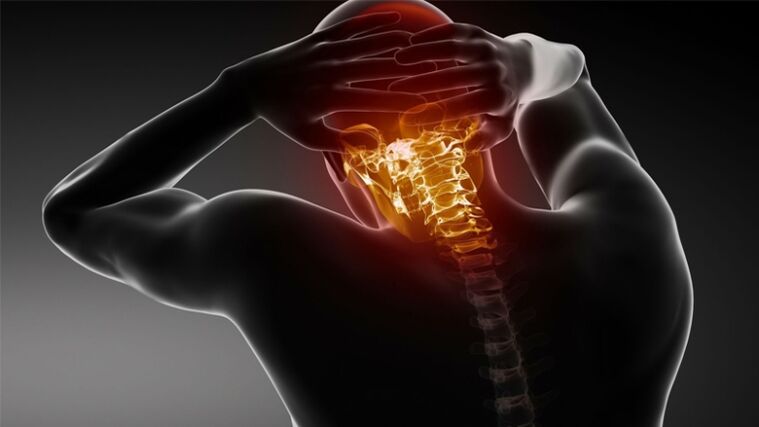 pain in the back of the head due to cervical spondylosis