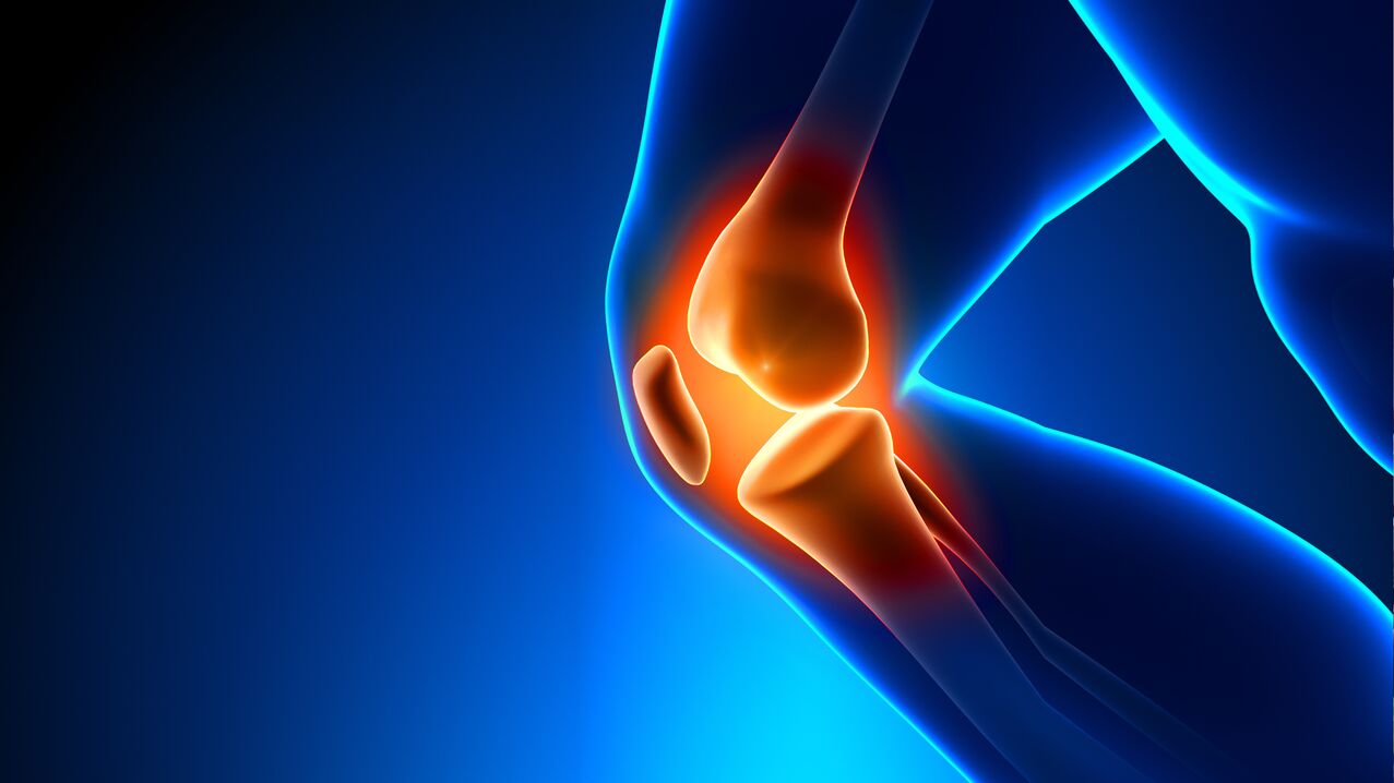 arthritis